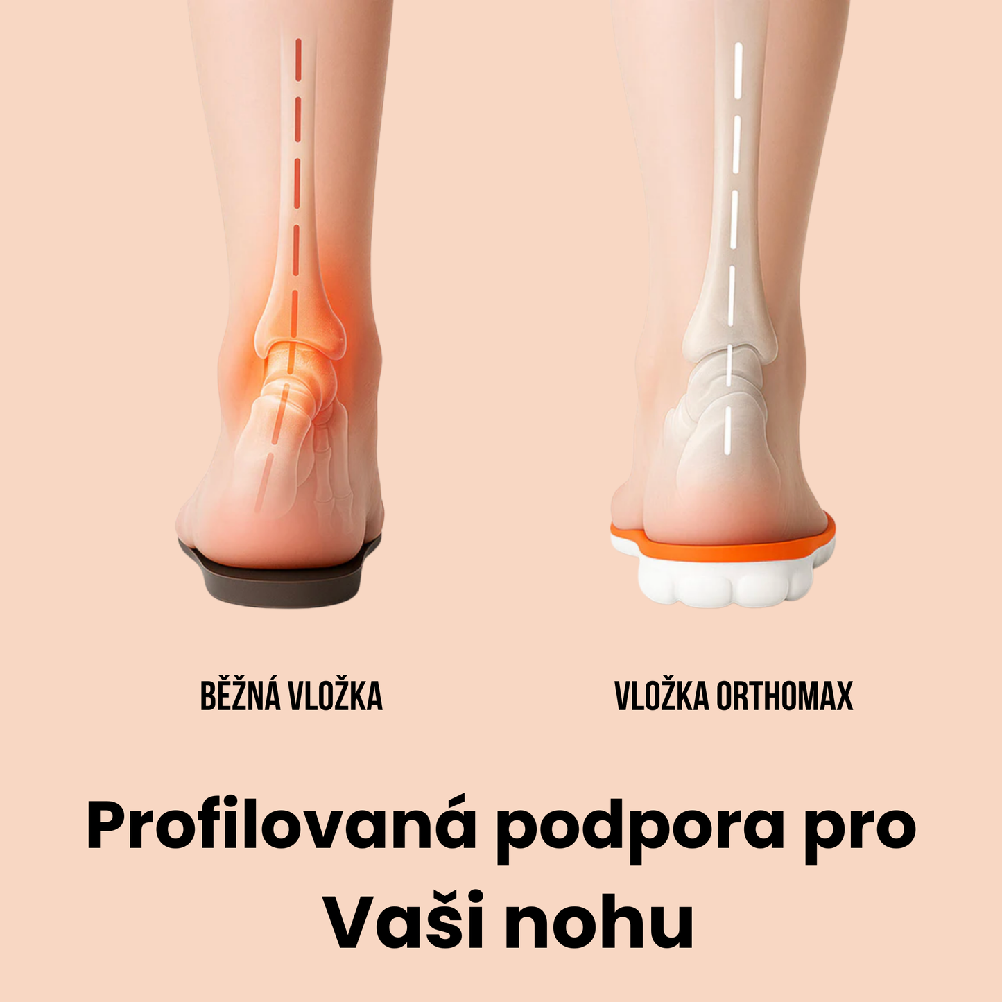 Tvarované vložky StepMax